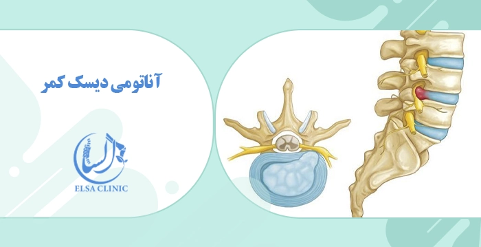 آناتومی دیسک کمر