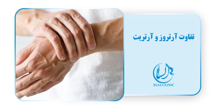 تفاوت آرتروز و آرتریت