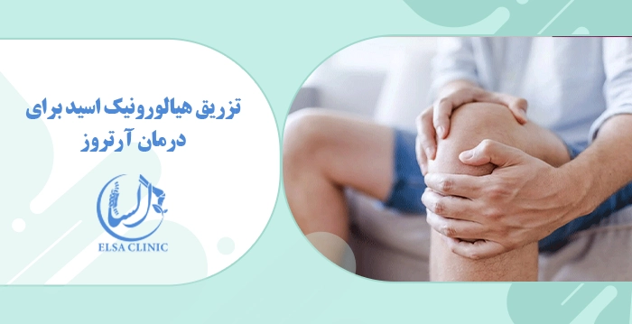 تزریق هیالورونیک اسید برای درمان آرتروز