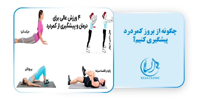 چگونه از بروز کمردرد پیشگیری کنیم؟