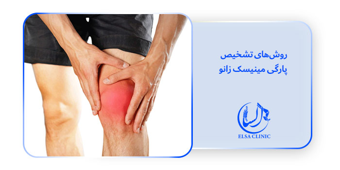 روش‌های تشخیص پارگی مینیسک زانو