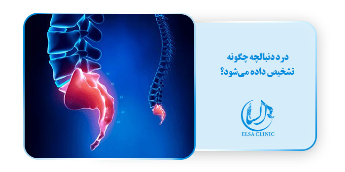 درد دنبالچه چگونه تشخیص داده می‌شود؟