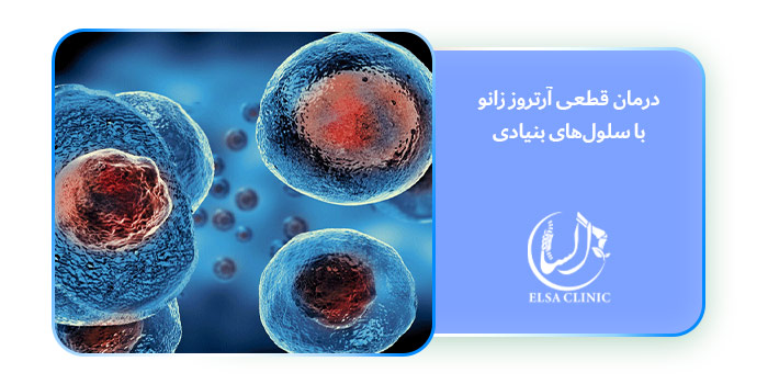درمان قطعی آرتروز زانو با سلول‌های بنیادی