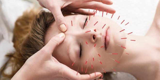 طب سوزنی و دردهای گردن،کمر و سردرد، مزایا و کاربردها