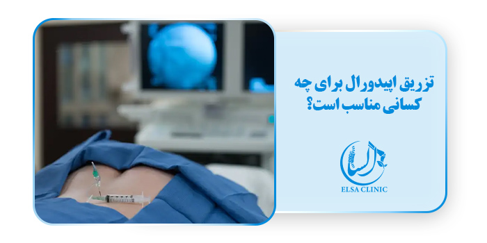 تزریق اپیدورال برای چه کسانی مناسب است؟