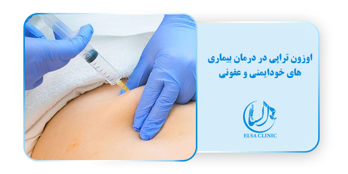 اوزون تراپی در درمان بیماری‌های خودایمنی و عفونی