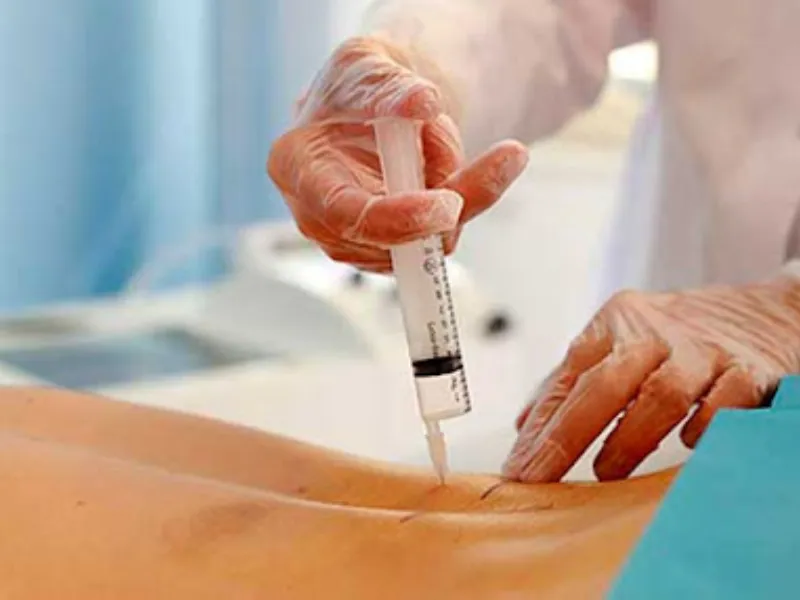 اوزون تراپی دیسک کمر