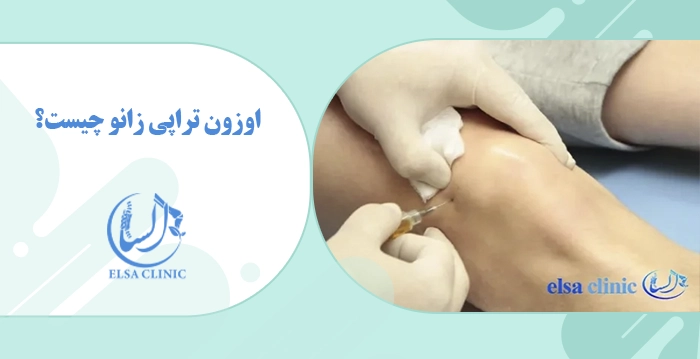 اوزون تراپی زانو چیست؟
