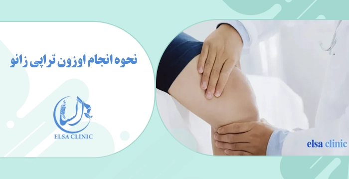 نحوه انجام اوزون تراپی زانو