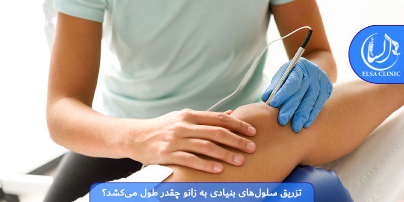 تزریق سلول‌های بنیادی به زانو چقدر طول می‌کشد؟