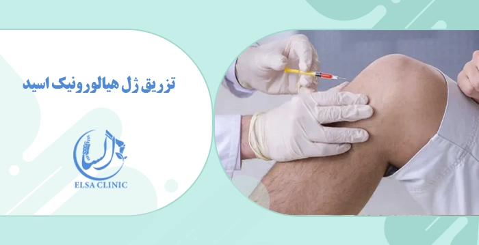 تزریق ژل هیالورونیک اسید