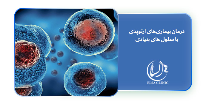 درمان بیماری‌های ارتوپدی با سلول های بنیادی