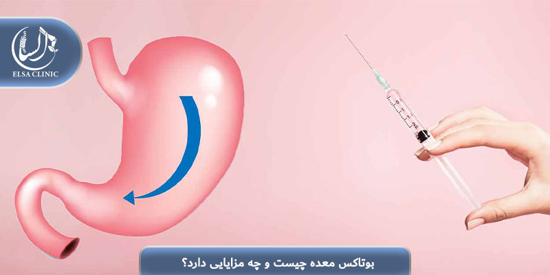 بوتاکس معده چیست و چه مزایایی دارد؟