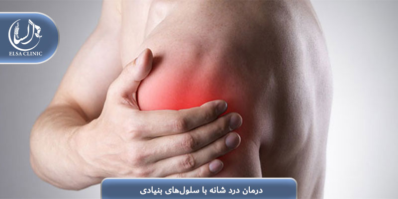 درمان درد شانه با سلول‌های بنیادی
