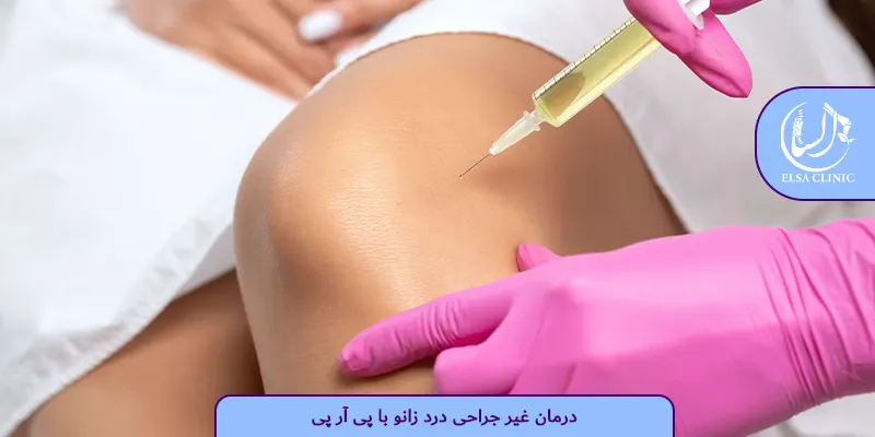 درمان غیر جراحی درد زانو با پی آر پی