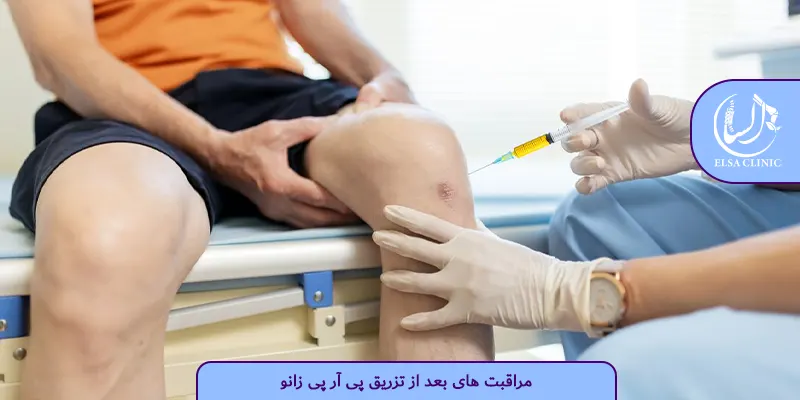 مراقبت های بعد از تزریق پی آر پی زانو