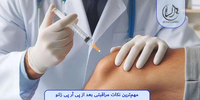 مهم‌ترین نکات مراقبتی بعد از پی آر پی زانو