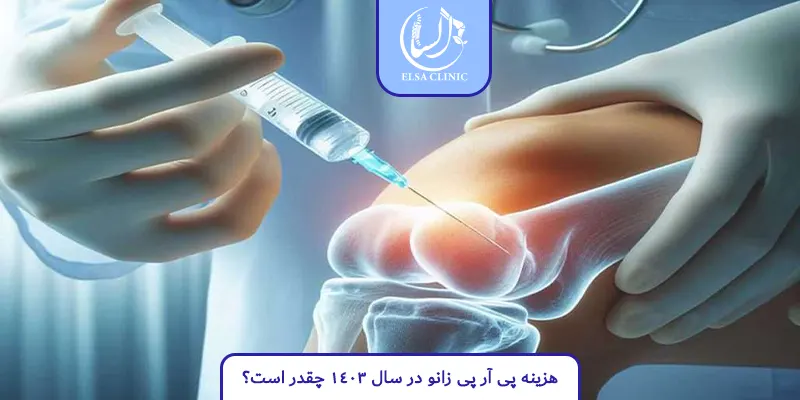 هزینه پی آر پی زانو در سال 1403 چقدر است؟