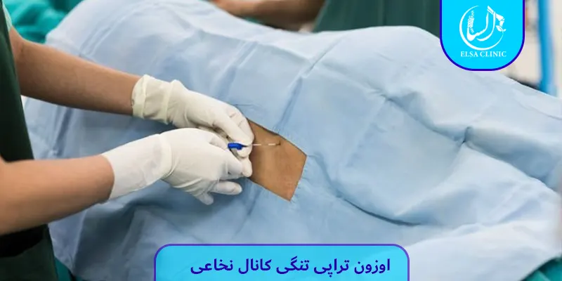 اوزون تراپی تنگی کانال نخاعی 