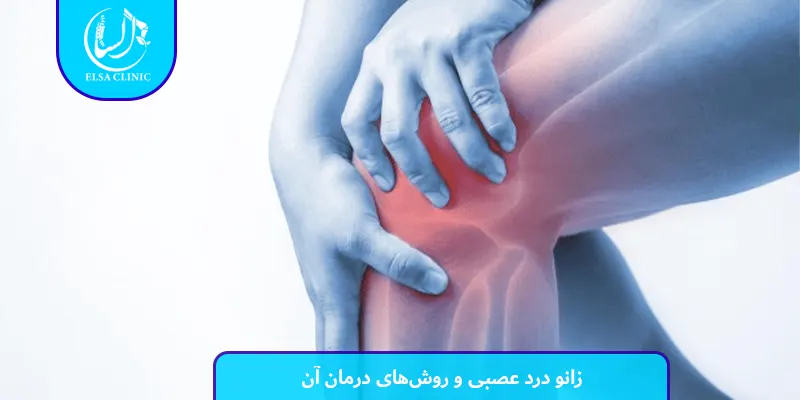 زانو درد عصبی و روش‌های درمان آن