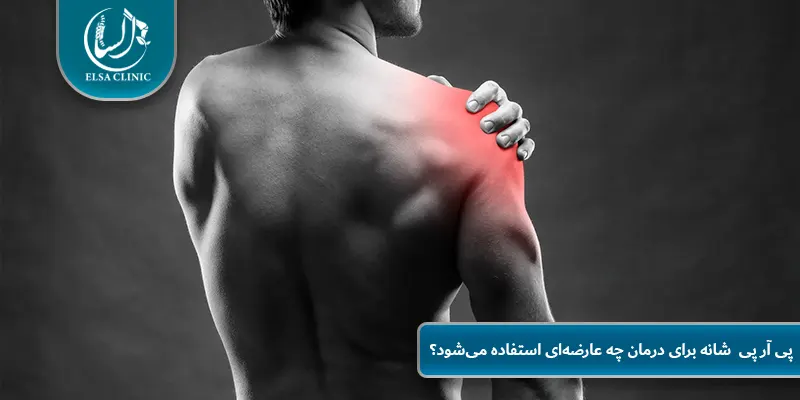  پی آر پی  شانه برای درمان چه عارضه‌ای استفاده می‌شود؟