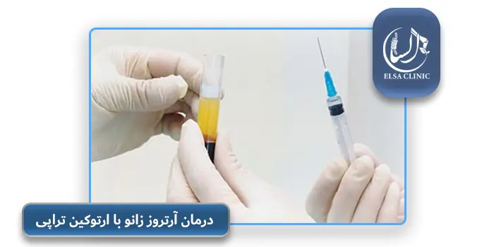 درمان آرتروز زانو با ارتوکین تراپی