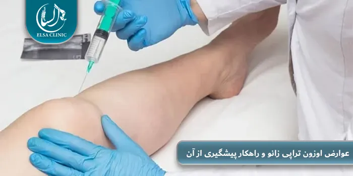 عوارض اوزون تراپی زانو و راهکار پیشگیری از آن