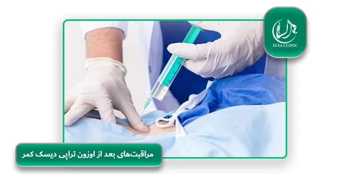 مراقبت‌های بعد از اوزون تراپی دیسک کمر