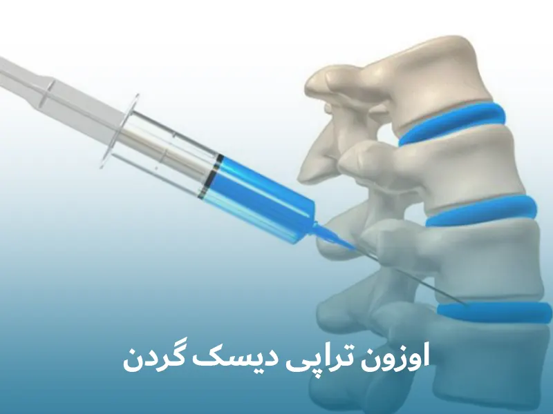 اوزون تراپی دیسک گردن