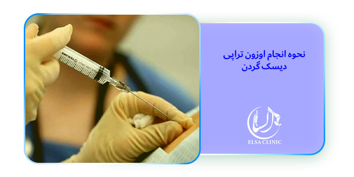 نحوه انجام اوزون تراپی دیسک گردن