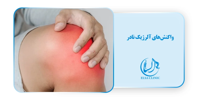 واکنش‌های آلرژیک نادر