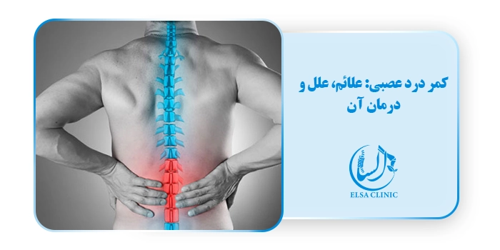 کمر درد عصبی: علائم، علل و درمان آن