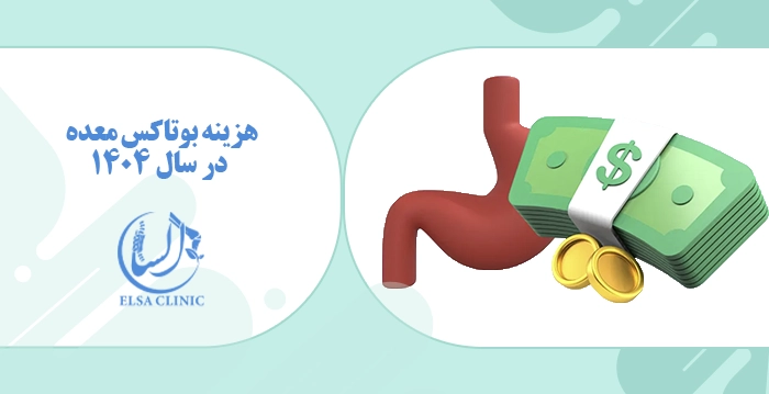 هزینه بوتاکس معده در سال 1404