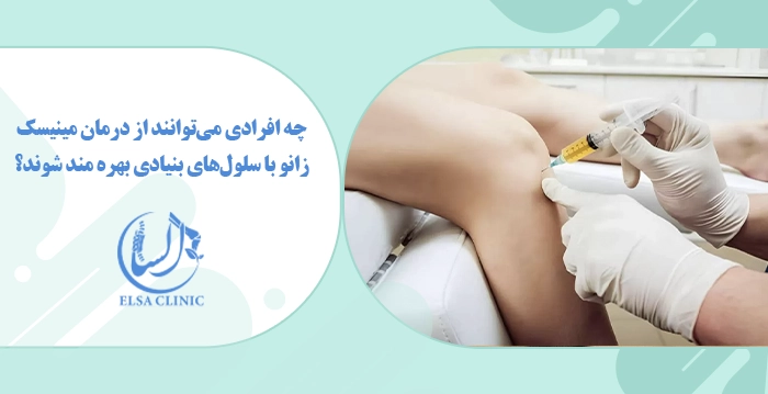 چه افرادی می‌توانند از درمان مینیسک زانو با سلول‌های بنیادی بهره مند شوند؟
