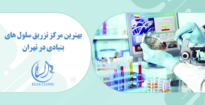 بهترین مرکز تزریق سلول های بنیادی در تهران