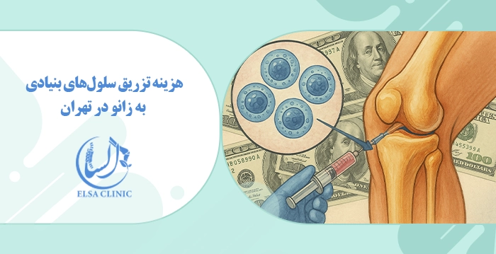 هزینه تزریق سلول‌های بنیادی به زانو در تهران 1404