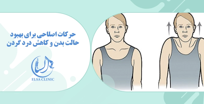 حرکات اصلاحی برای بهبود حالت بدن و کاهش درد گردن