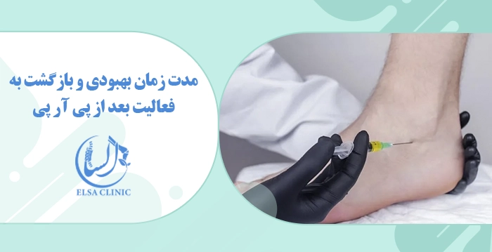 مدت زمان بهبودی و بازگشت به فعالیت بعد از پی آر پی