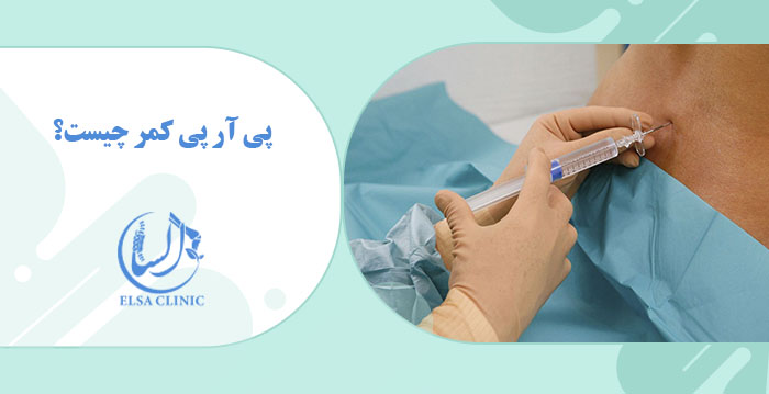 پی آر پی کمر چیست؟