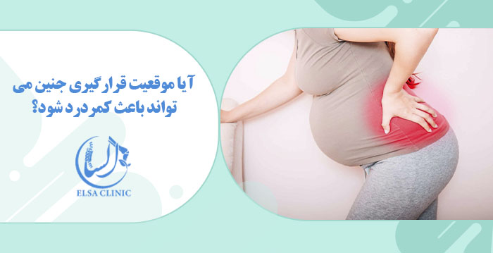 آیا موقعیت قرارگیری جنین می‌تواند باعث کمردرد شود؟