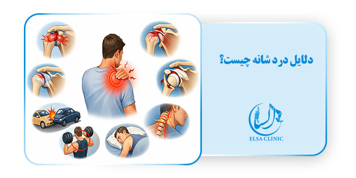 دلایل درد شانه چیست؟
