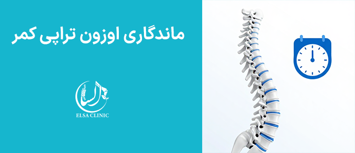 ماندگاری اوزون تراپی کمر