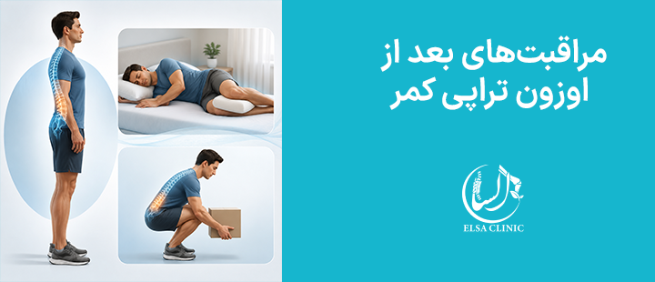 مراقبت‌های بعد از اوزون تراپی کمر