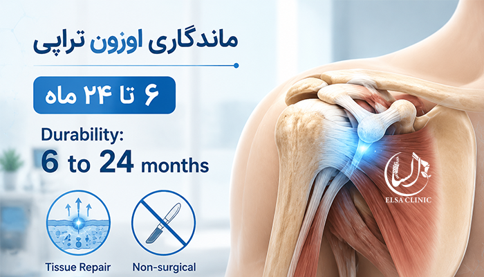 ماندگاری اوزون تراپی شانه