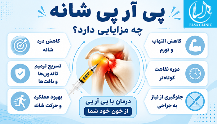 مزایای پی آر پی شانه